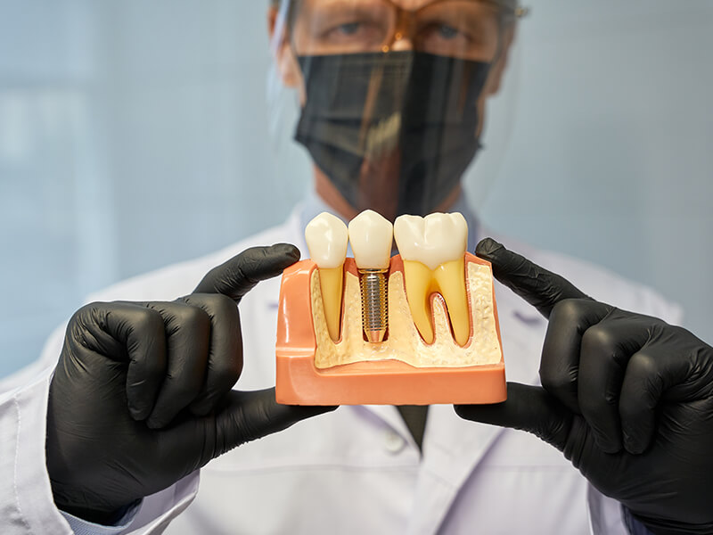 implante dentário