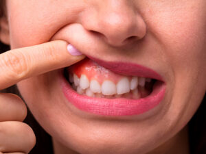 periodontia