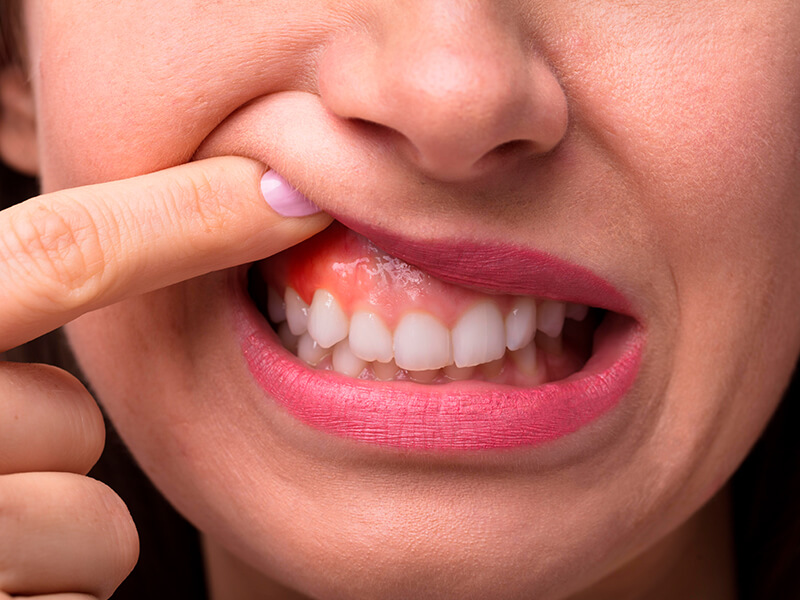 periodontia