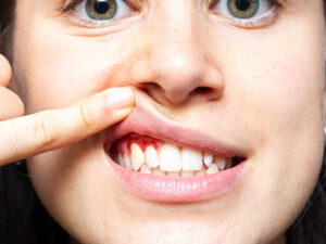 periodontia